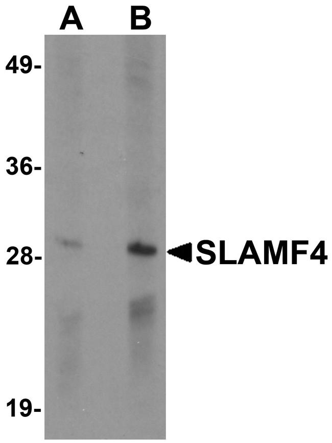 CD244 Antibody in Western Blot (WB)