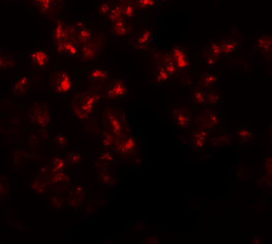 EZH2 Antibody in Immunocytochemistry (ICC/IF)