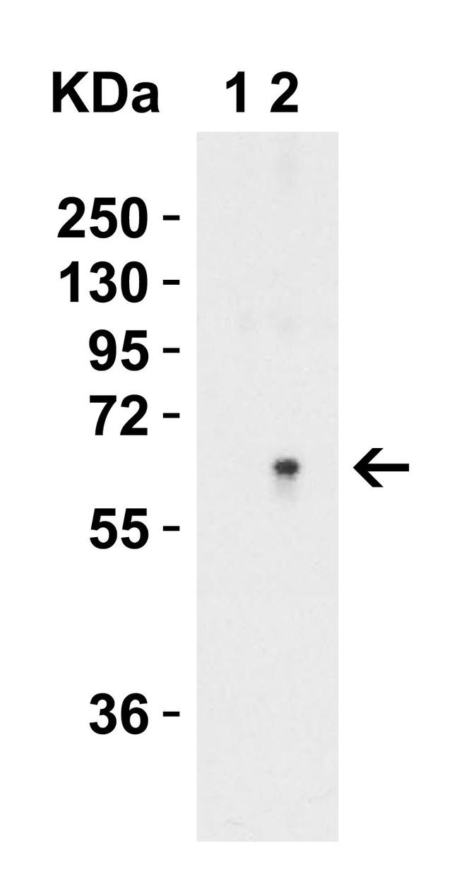 SPTLC2 Antibody in Western Blot (WB)