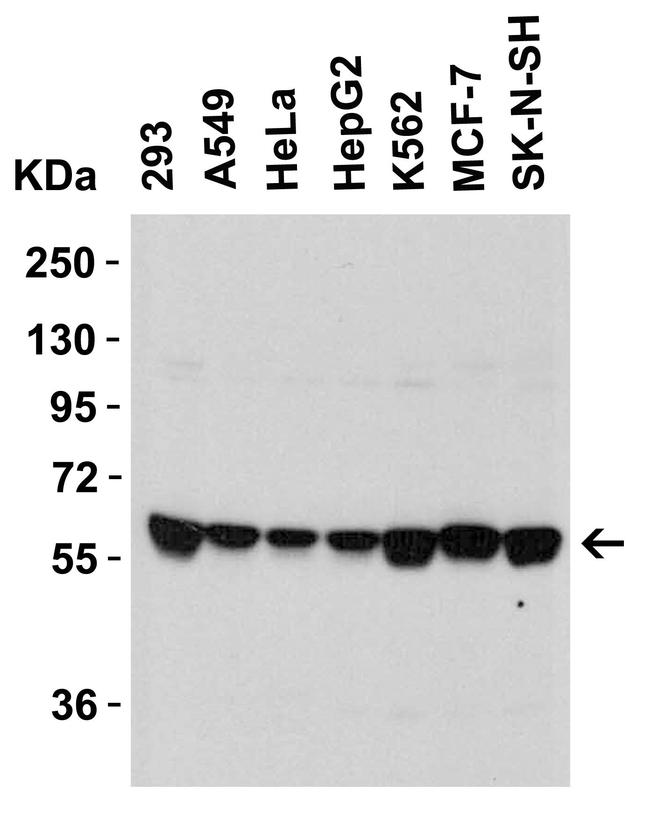 SPTLC2 Antibody in Western Blot (WB)