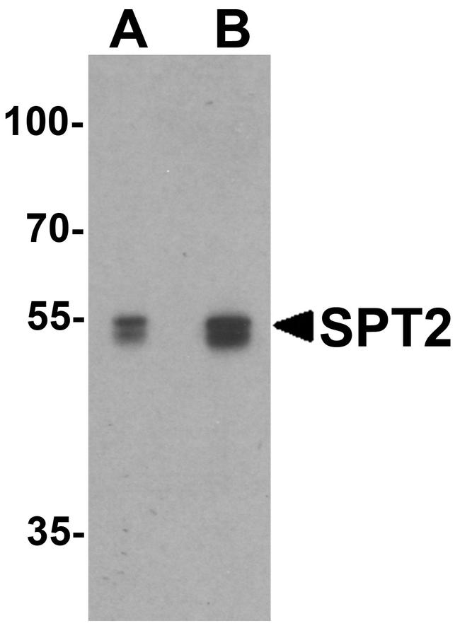 SPTLC2 Antibody in Western Blot (WB)