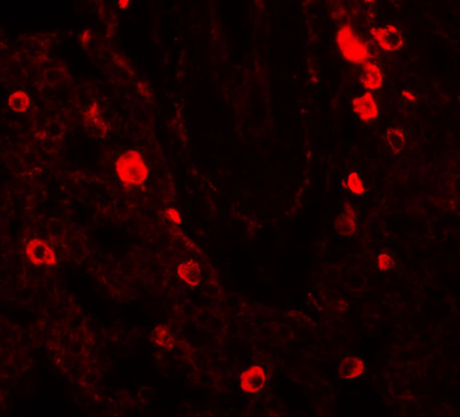 NUMB Antibody in Immunohistochemistry (IHC)