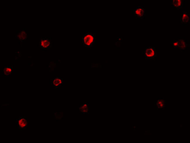 IRF4 Antibody in Immunocytochemistry (ICC/IF)