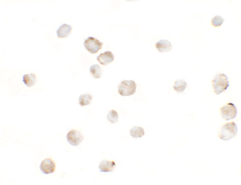 MSI2 Antibody in Immunocytochemistry (ICC/IF)