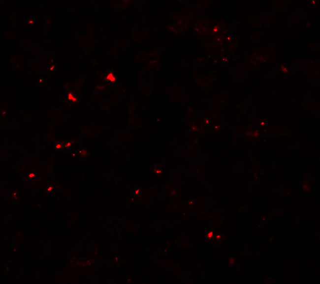 MSI2 Antibody in Immunocytochemistry (ICC/IF)