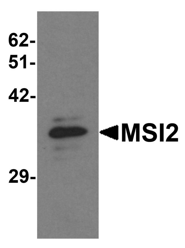 MSI2 Antibody in Western Blot (WB)