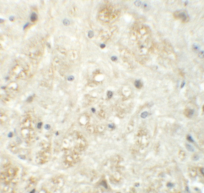 VASH1 Antibody in Immunohistochemistry (IHC)