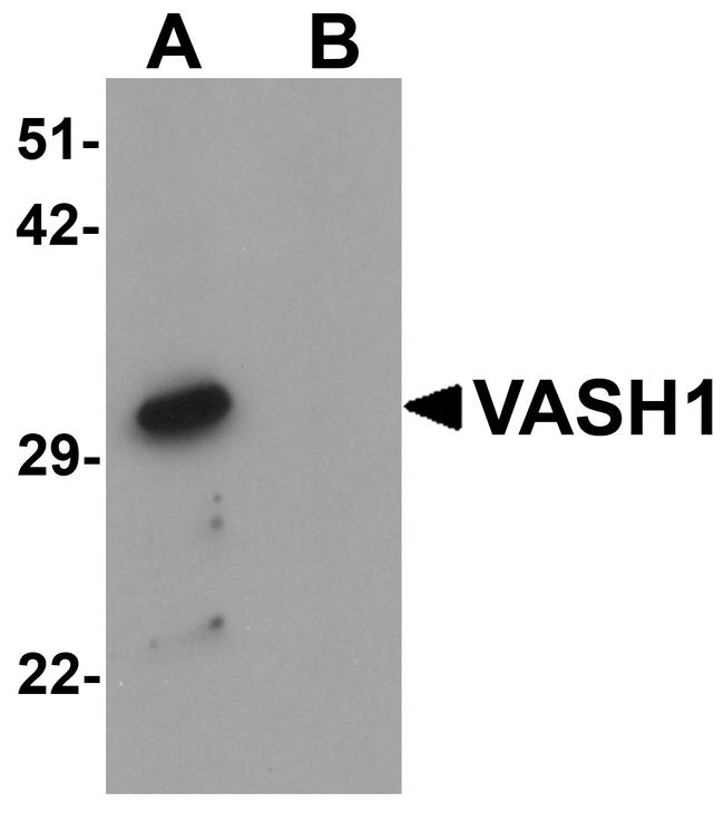 VASH1 Antibody in Western Blot (WB)