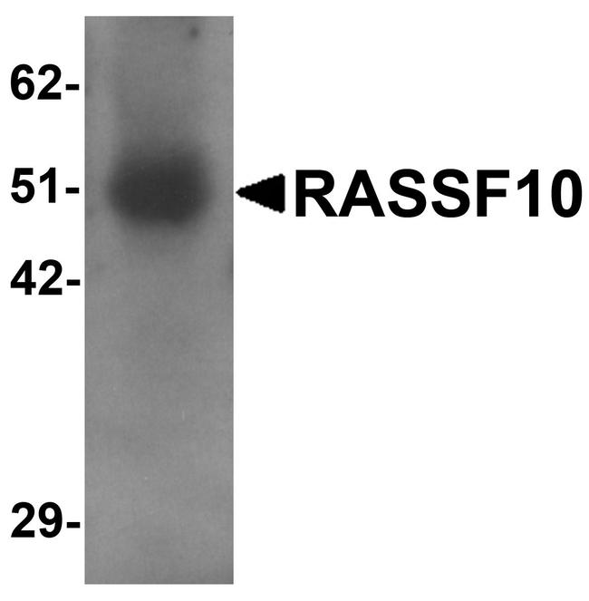 RASSF10 Antibody in Western Blot (WB)