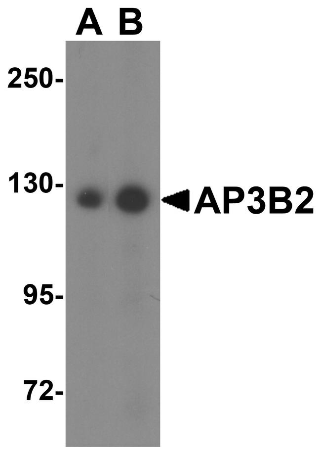 AP3B2 Antibody in Western Blot (WB)