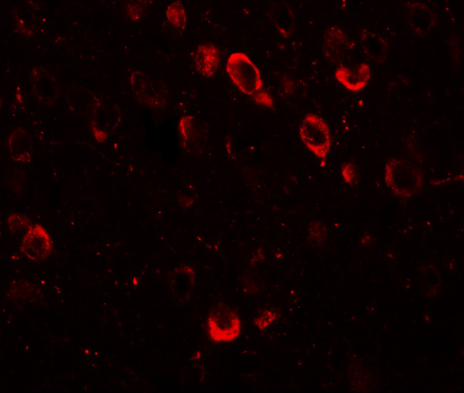 SPRYD2 Antibody in Immunohistochemistry (IHC)