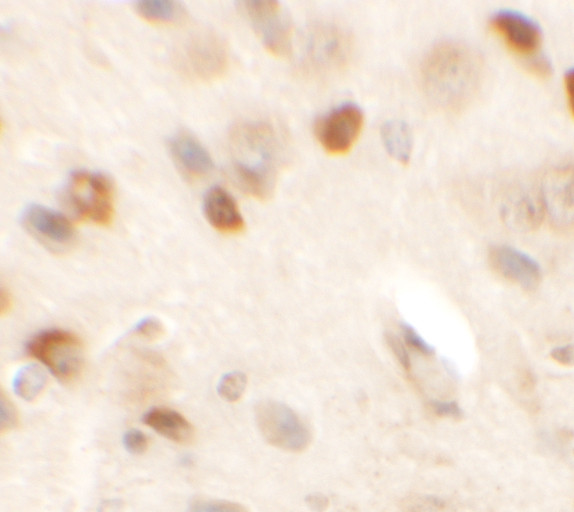 SPRYD2 Antibody in Immunohistochemistry (IHC)