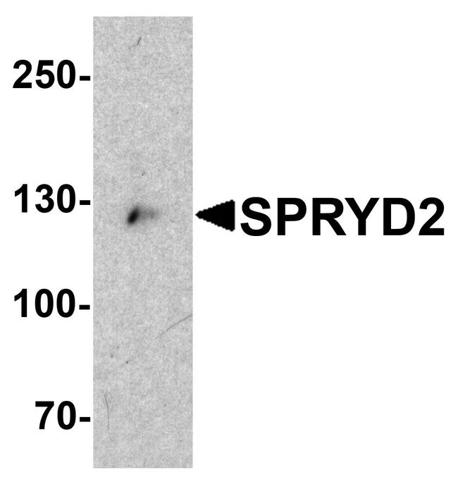 SPRYD2 Antibody in Western Blot (WB)