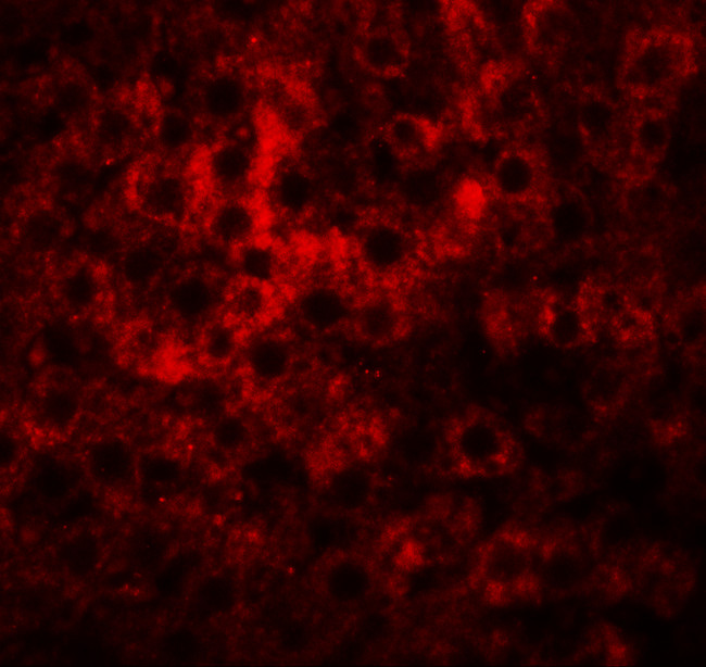 HDGFRP2 Antibody in Immunohistochemistry (IHC)