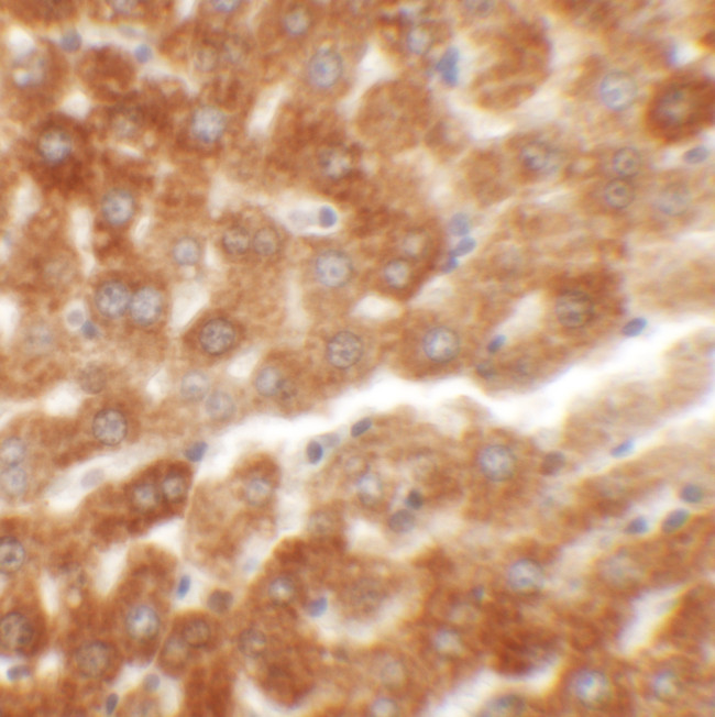 HDGFRP2 Antibody in Immunohistochemistry (IHC)