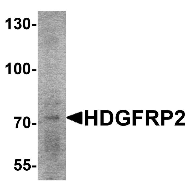 HDGFRP2 Antibody in Western Blot (WB)