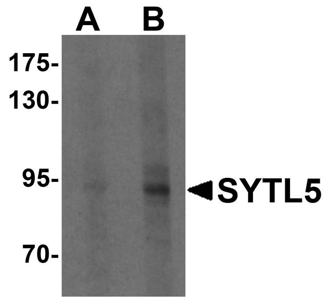 SYTL5 Antibody in Western Blot (WB)