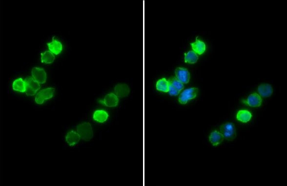 IBA1 Antibody in Immunocytochemistry (ICC/IF)