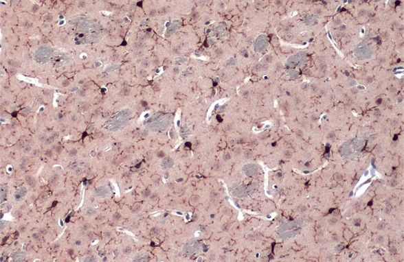 IBA1 Antibody in Immunohistochemistry (Paraffin) (IHC (P))