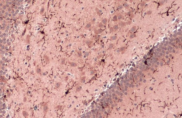 IBA1 Antibody in Immunohistochemistry (Paraffin) (IHC (P))