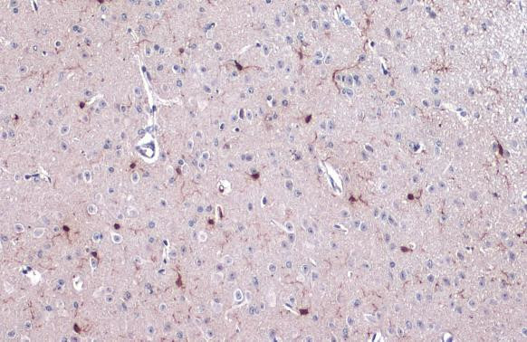 IBA1 Antibody in Immunohistochemistry (Paraffin) (IHC (P))