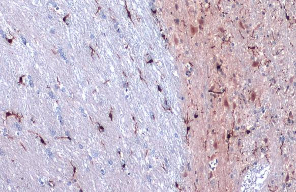 IBA1 Antibody in Immunohistochemistry (Paraffin) (IHC (P))