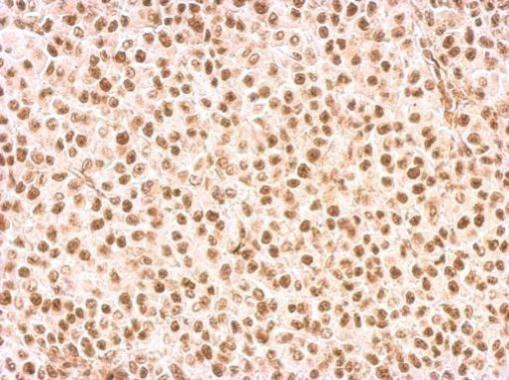 RAD9 Antibody in Immunohistochemistry (Paraffin) (IHC (P))