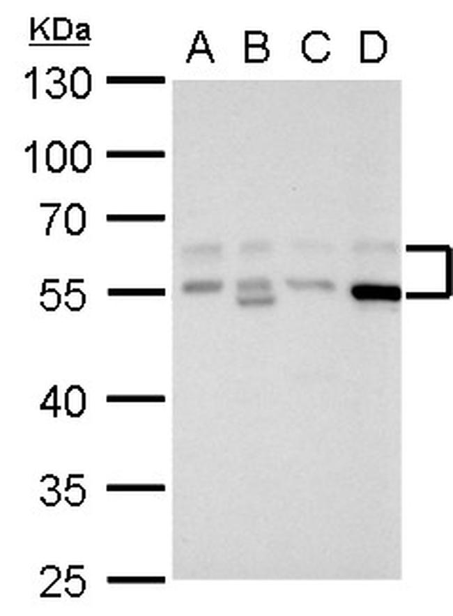 RAD9 Antibody in Western Blot (WB)