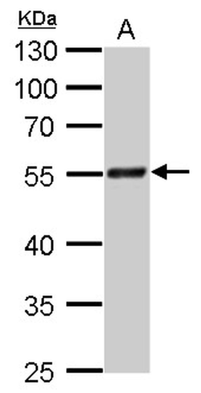 RAD9 Antibody in Western Blot (WB)