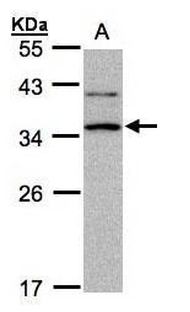 XRCC2 Antibody in Western Blot (WB)