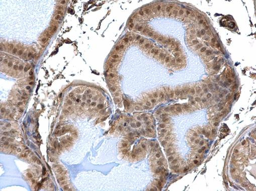 DDB1 Antibody in Immunohistochemistry (Paraffin) (IHC (P))