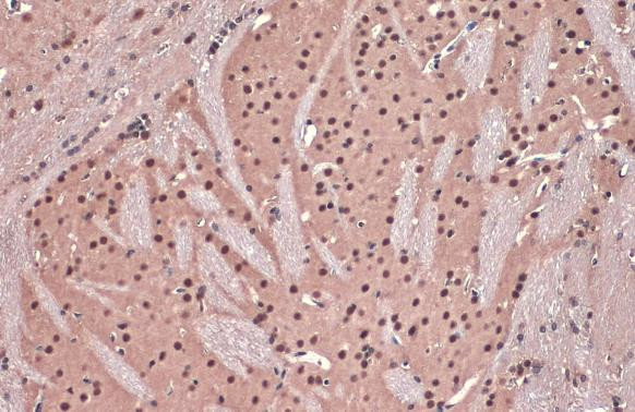 DDB1 Antibody in Immunohistochemistry (Paraffin) (IHC (P))