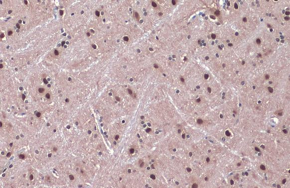 DDB1 Antibody in Immunohistochemistry (Paraffin) (IHC (P))