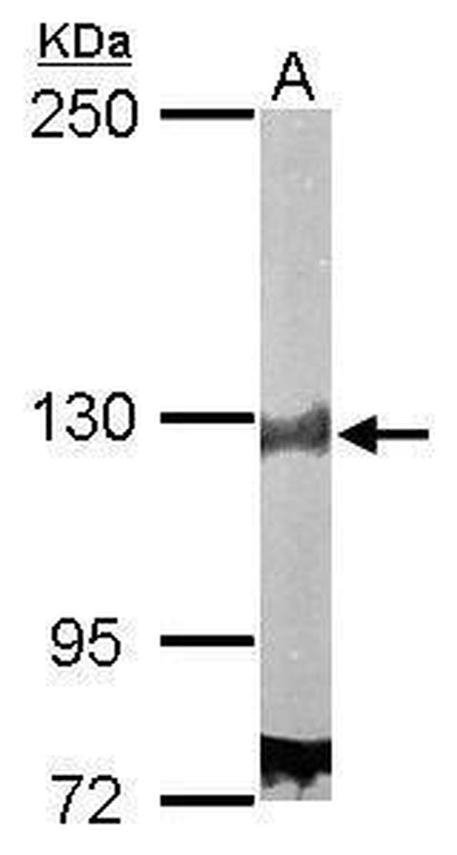 DDB1 Antibody in Western Blot (WB)