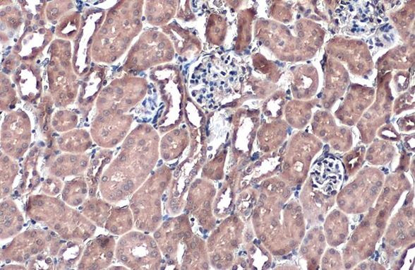 NQO1 Antibody in Immunohistochemistry (Paraffin) (IHC (P))