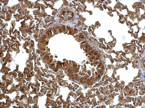 EML1 Antibody in Immunohistochemistry (Paraffin) (IHC (P))