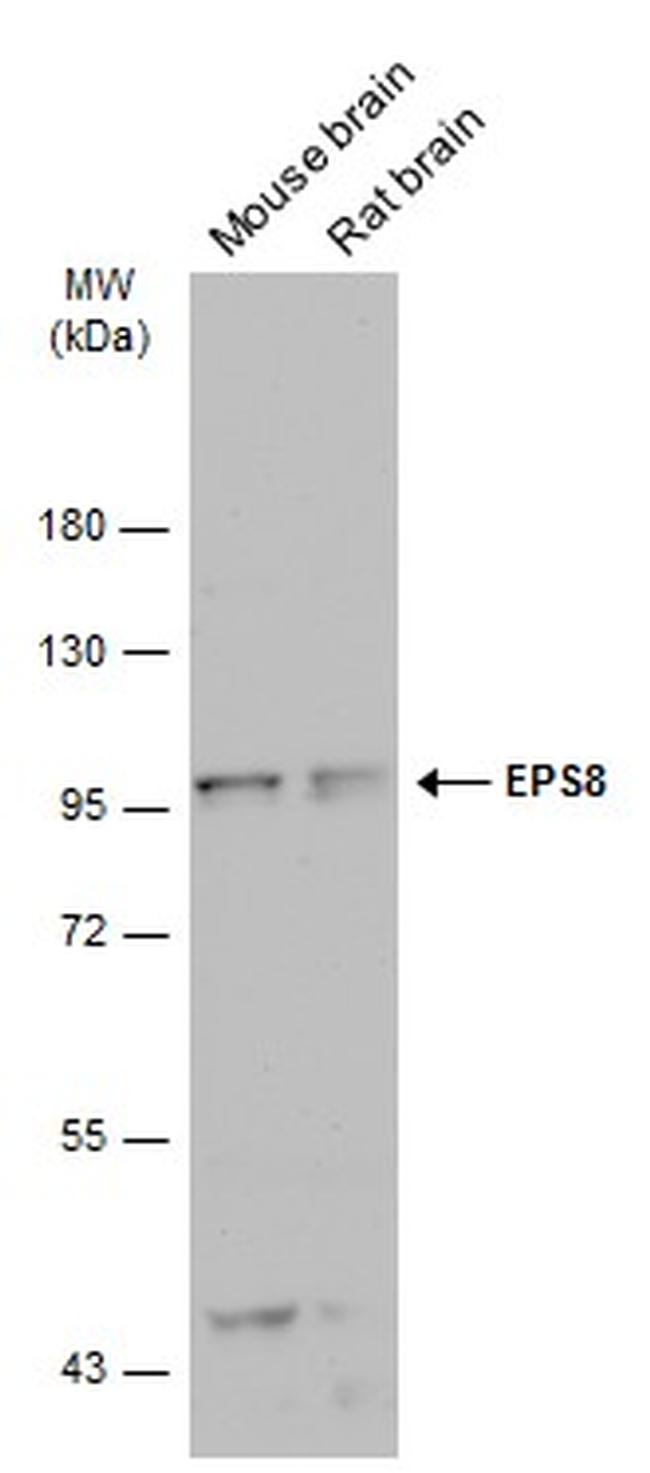 EPS8 Antibody in Western Blot (WB)