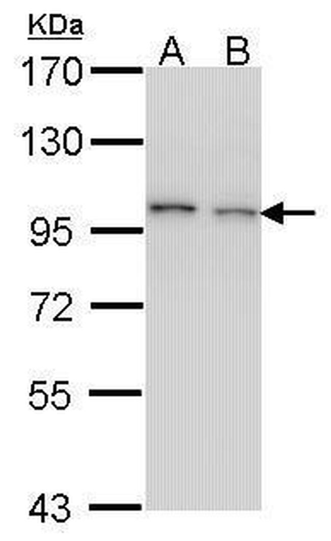 EPS8 Antibody in Western Blot (WB)