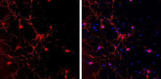 GAD65 Antibody in Immunocytochemistry (ICC/IF)