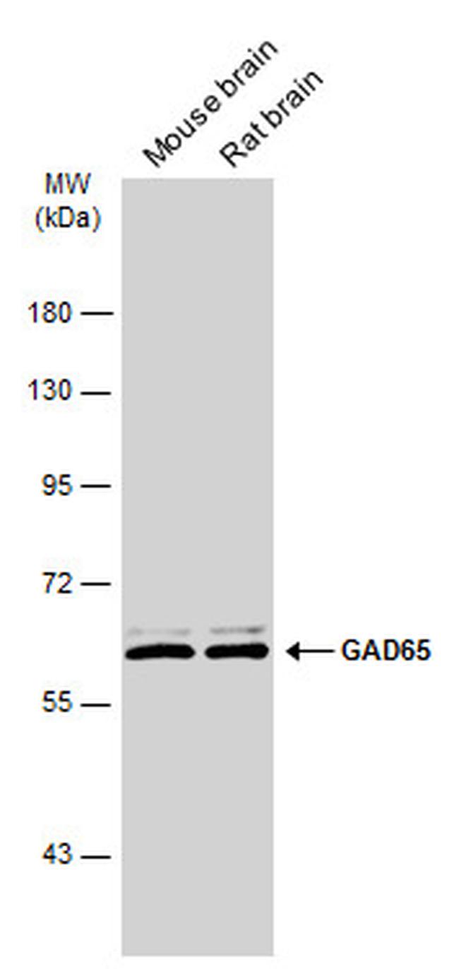 GAD65 Antibody in Western Blot (WB)