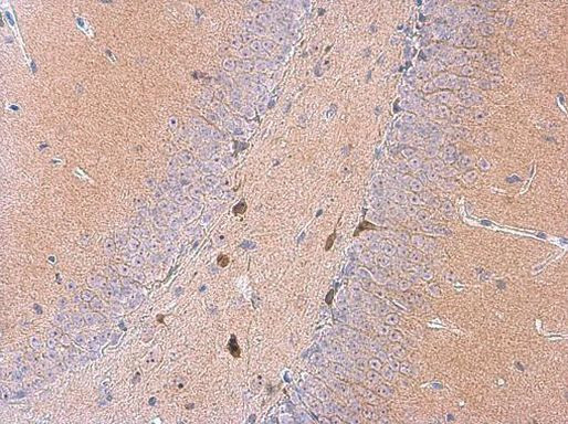 GALR2 Antibody in Immunohistochemistry (Paraffin) (IHC (P))