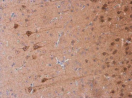 GALR2 Antibody in Immunohistochemistry (Paraffin) (IHC (P))