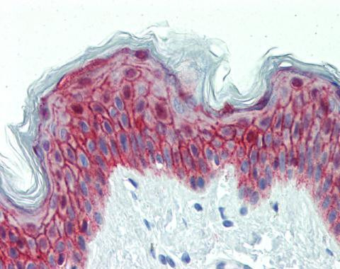 GALR2 Antibody in Immunohistochemistry (Paraffin) (IHC (P))