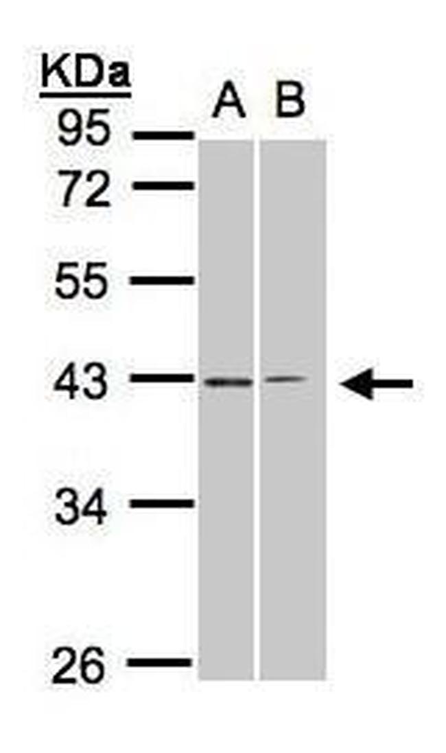 GALR2 Antibody in Western Blot (WB)