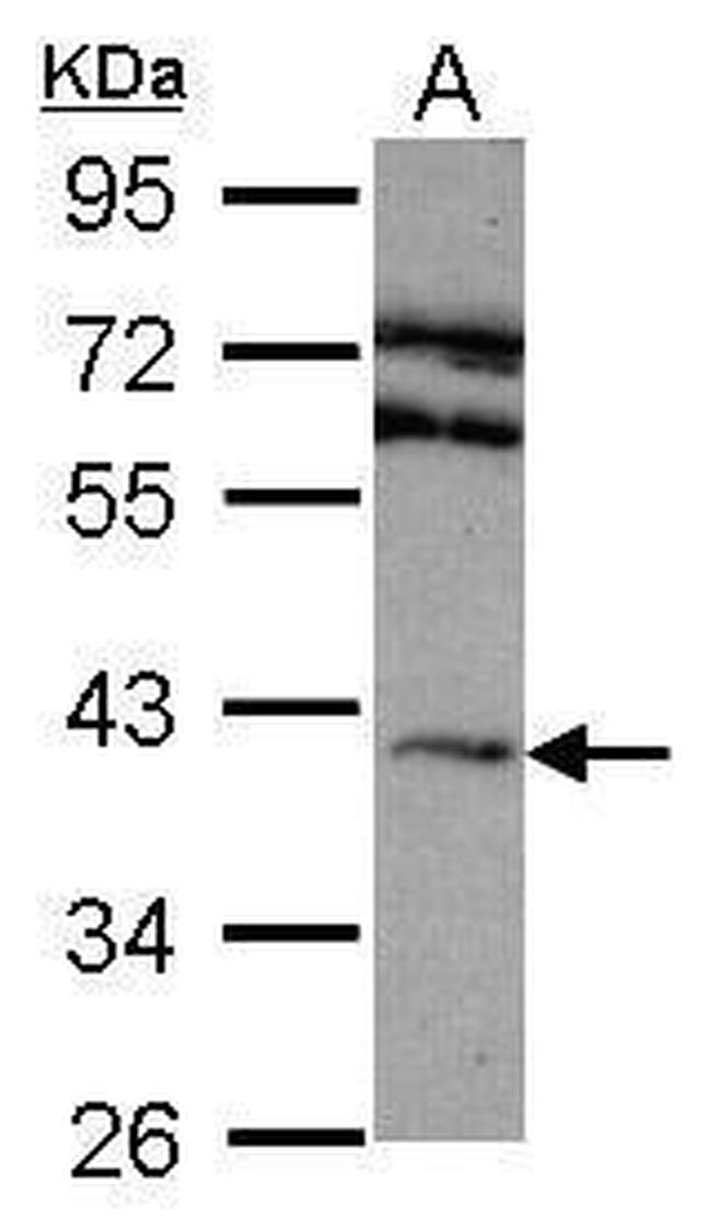 ADORA2A Antibody in Western Blot (WB)