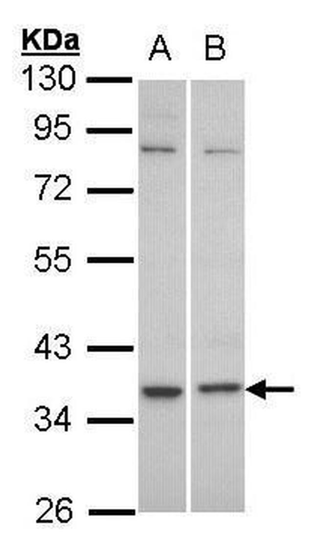 GPR77 Antibody in Western Blot (WB)