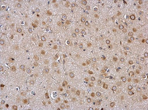 GALR2 Antibody in Immunohistochemistry (Paraffin) (IHC (P))