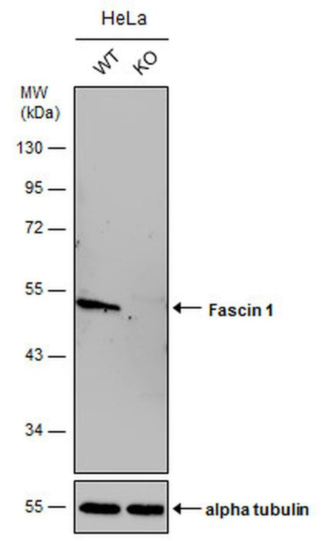 Fascin Antibody