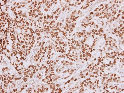 HMGA2 Antibody in Immunohistochemistry (Paraffin) (IHC (P))