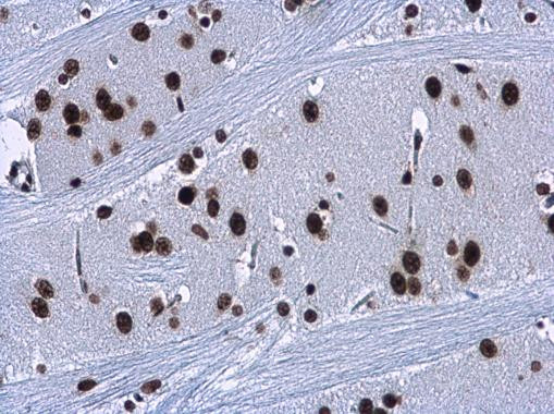 HMGA2 Antibody in Immunohistochemistry (Paraffin) (IHC (P))